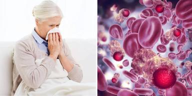 En kvinna är förkyld och illustration av cancerceller.. Vilande cancerceller kan väckas till liv av en vanlig förkylning.