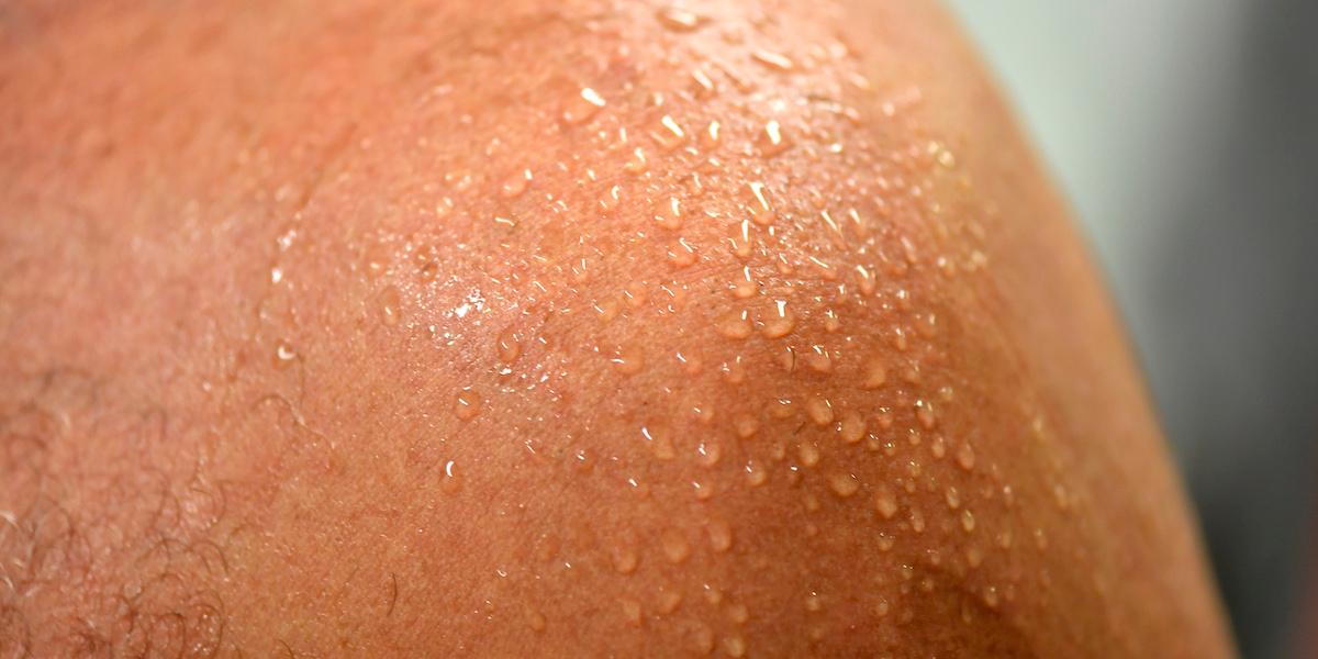 En svettig skuldra. Känns det som du svettas mer än normalt? Så här kan du ta reda på det