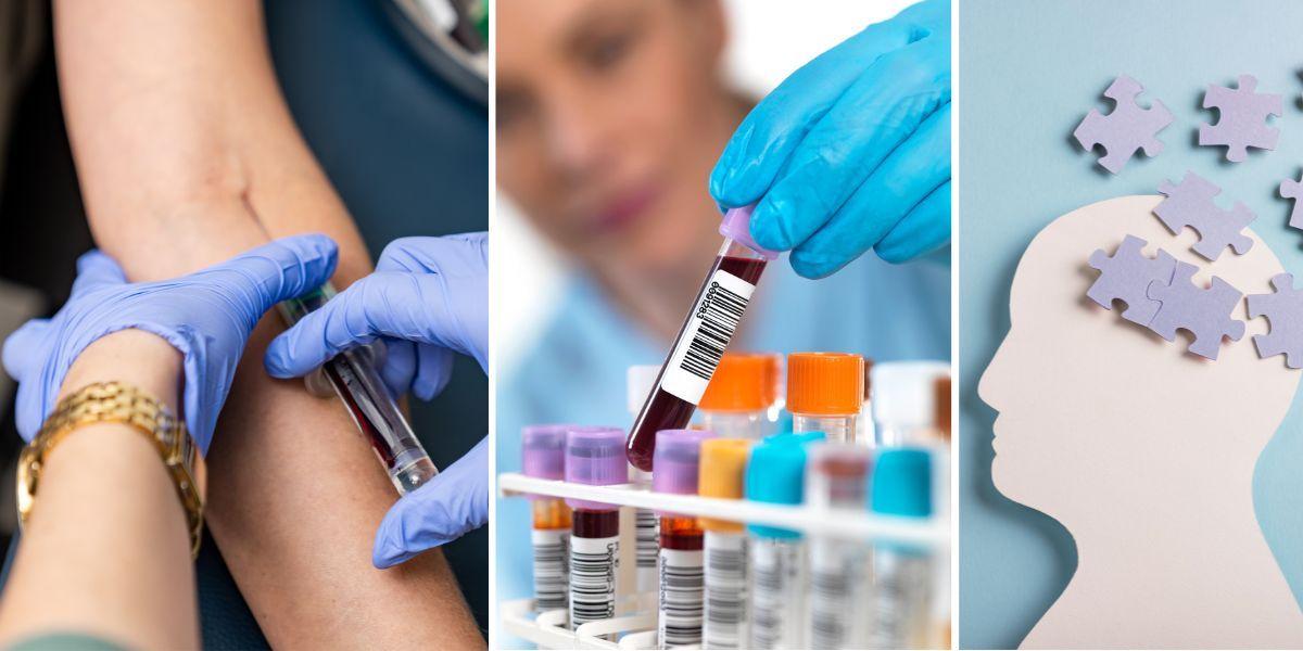 någon tar blodprov, blodprov analyseras och ett huvud som tappat pusselbitar. Forskare har visat att tre biomarkörer i blodet kan förutse om en person kommer drabbas av demens