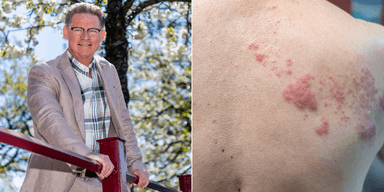 En man i kostym till vänster och en rygg med bältros till höger.