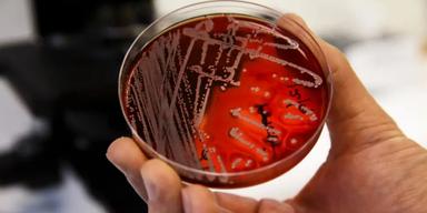 antibiotikaresistenta bakterier