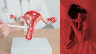 En modell av ett underliv med endometrios till vänster och en kvinna i fosterställning till höger.