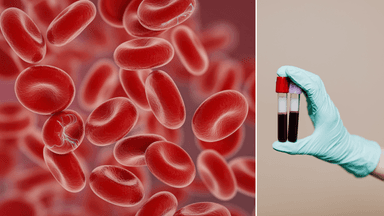 Blod som man använder i en ny behandling.