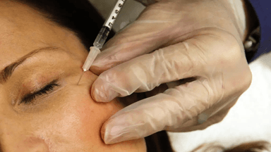 En kvinna som får botox.